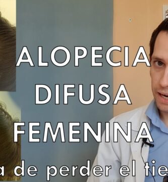 ¿Cómo cuidar mi alopecia?