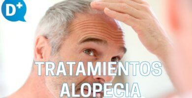 ¿Cómo curar la alopecia de forma natural?