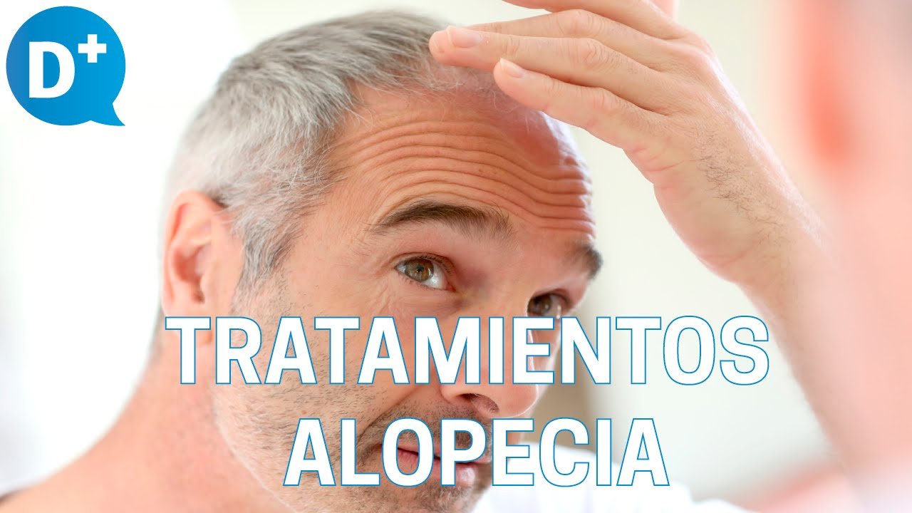 ¿Cómo curar la alopecia de forma natural?