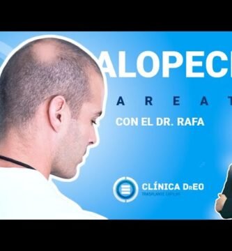 ¿Cómo saber si es alopecia o estrés?