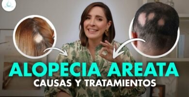 ¿Cómo se puede curar la alopecia areata?