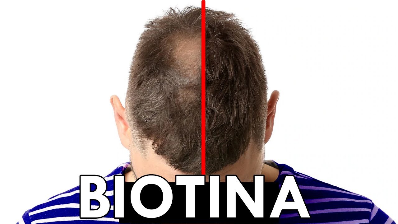 ¿Cómo se usa la biotina para el cabello?