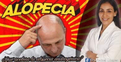 ¿Qué acelera la alopecia?