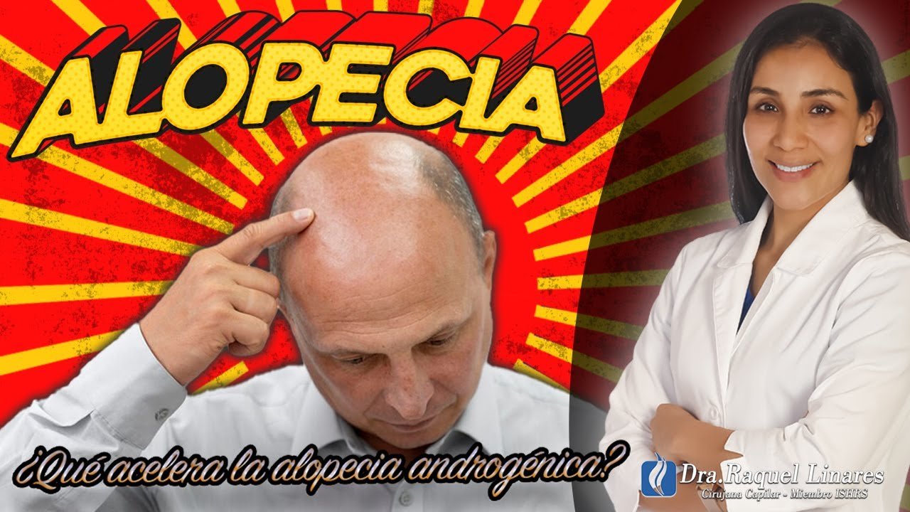 ¿Qué acelera la alopecia?