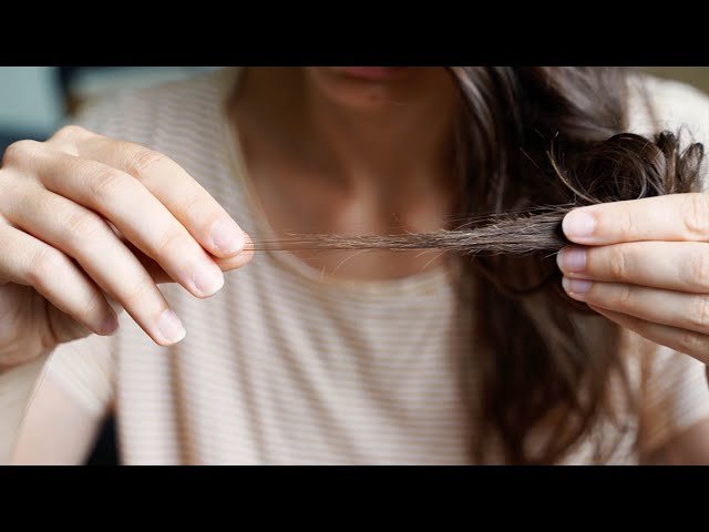 ¿Qué debo comer para evitar la caída del cabello?