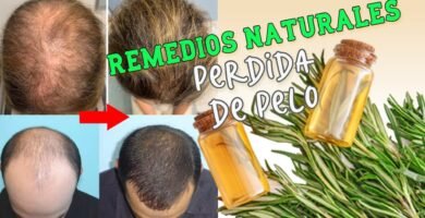 ¿Qué es bueno para que nazca y crezca el pelo?