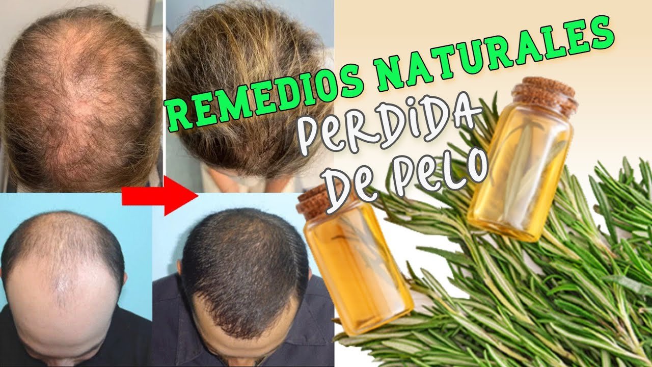 ¿Qué es bueno para que nazca y crezca el pelo?