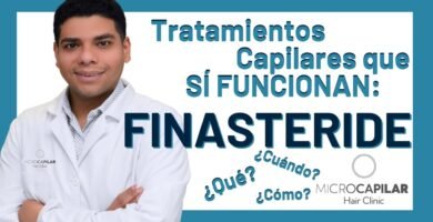 ¿Qué hace el finasteride en el pelo?