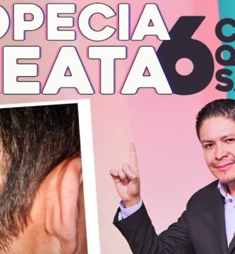 ¿Qué hacer si me está dando alopecia?