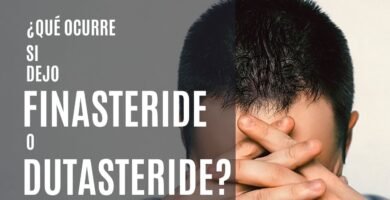 ¿Qué pasa si dejo de tomar finasteride para el cabello?