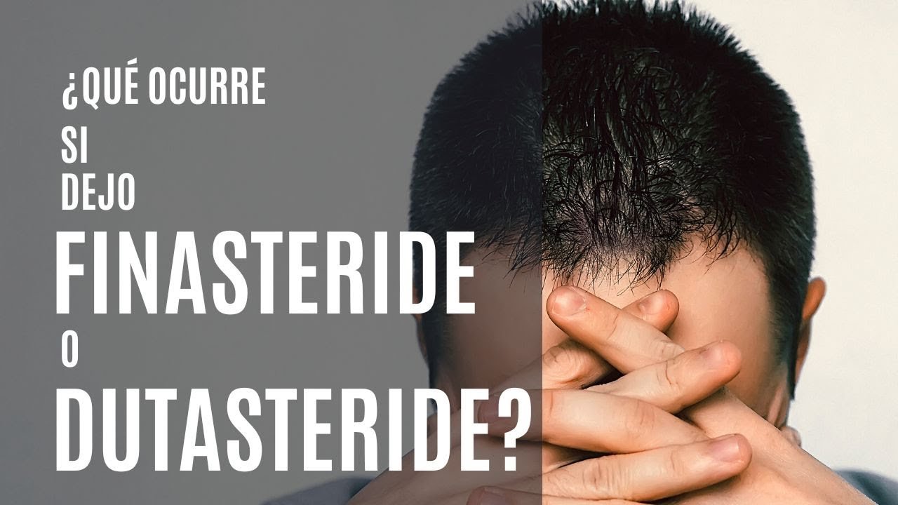 ¿Qué pasa si no tomo finasteride por 2 días?