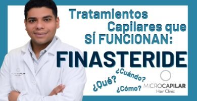 ¿Qué tan efectivo es finasteride?