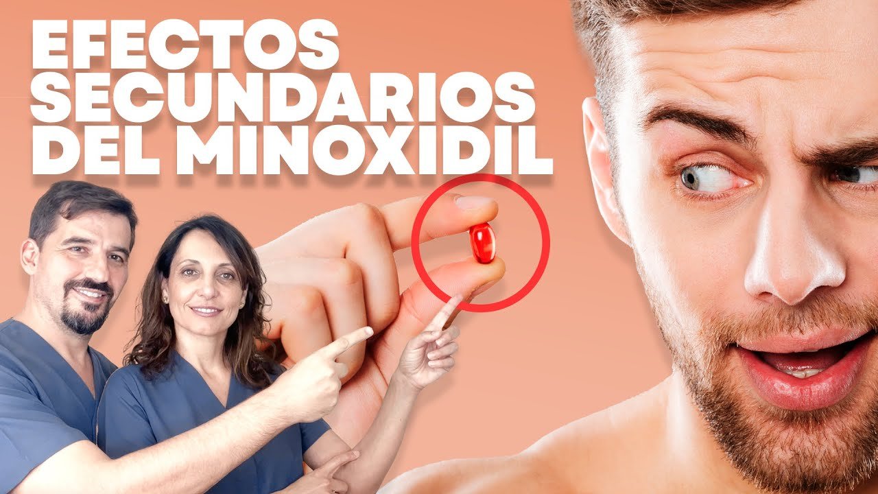 Efectos secundarios del minoxidil tópico