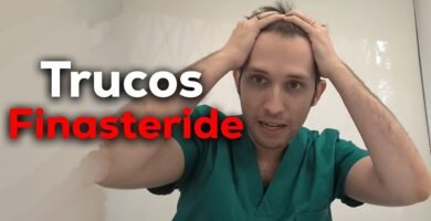 finasteride caída del cabello