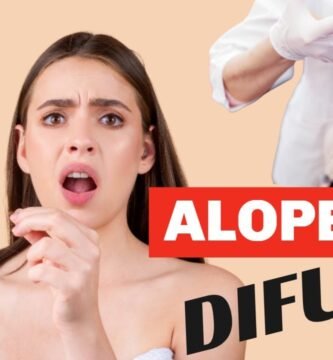 Alopecia difusa: causas y soluciones efectivas