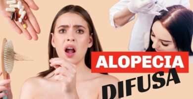 Alopecia difusa: causas y soluciones efectivas