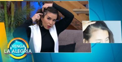Alopecia postparto: causas y soluciones efectivas