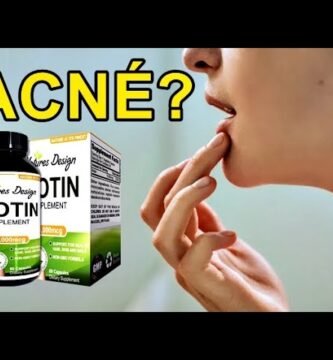 Biotina para el acné: ¿es efectiva?