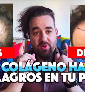 Importancia del colágeno frente a la implantes capilares