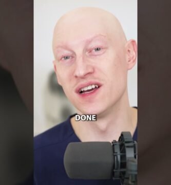 Minoxidil Kirkland vs Minoxidil You Minox: comparativa