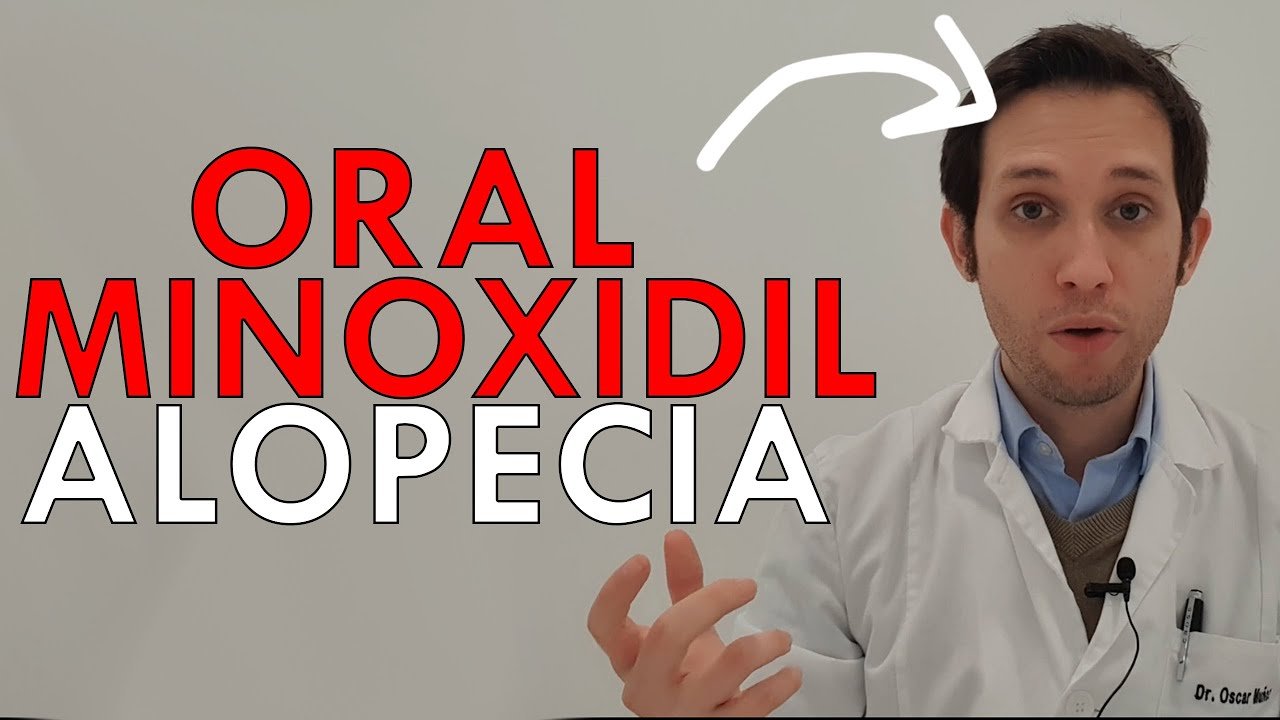 Minoxidil oral: dosis recomendada y efectos