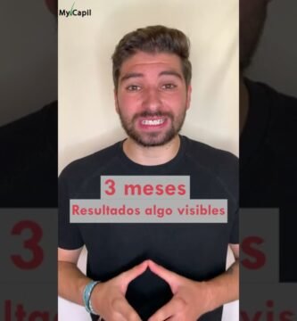 finasteride antes y después