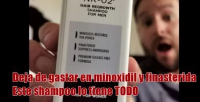 finasteride en shampoo funciona