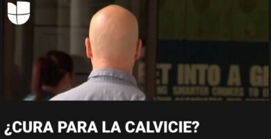 Avances científicos para tratar la calvicie