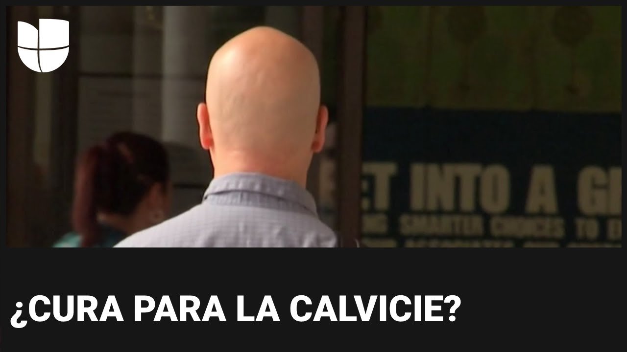 Avances científicos para tratar la calvicie