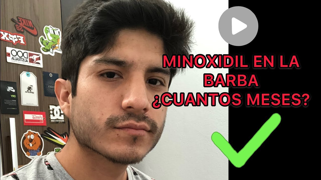 Minoxidil para barba: resultados en cuánto tiempo reseña