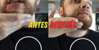 cómo evitar la caspa en la barba