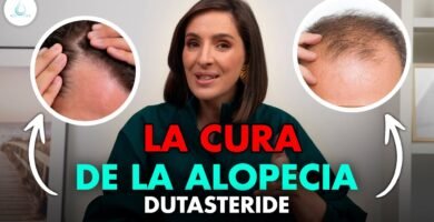 finasteride caída del cabello androgenética