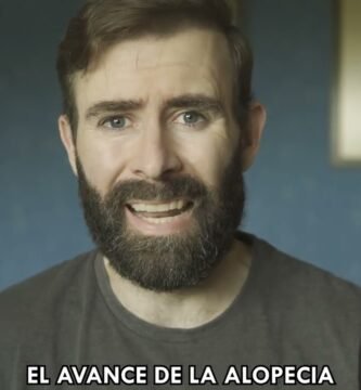finasteride sin receta en algunos países