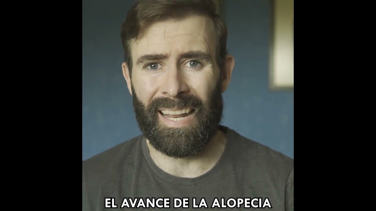 finasteride sin receta en algunos países