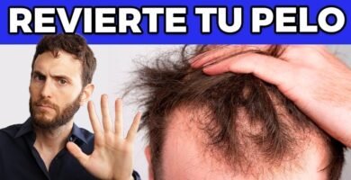 ¿Qué hacer si sufres de caída del cabello?