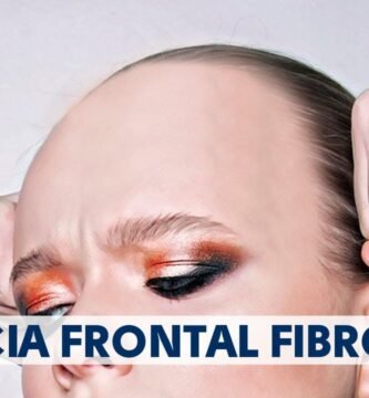Cómo saber si tienes alopecia frontal