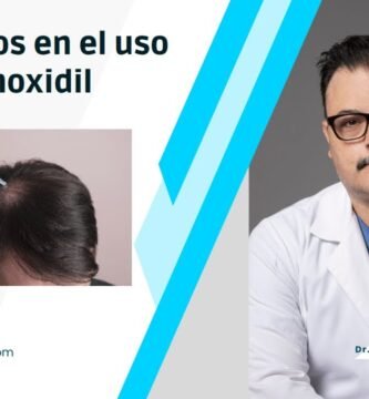 Efectos secundarios del minoxidil tópico beneficios