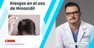 Efectos secundarios del minoxidil tópico beneficios