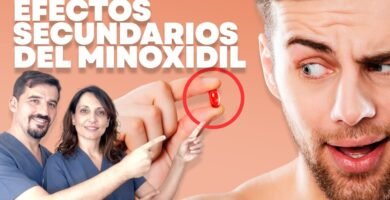 Efectos secundarios del minoxidil tópico reseña