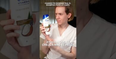Rutinas de cuidado para prevenir la alopecia total