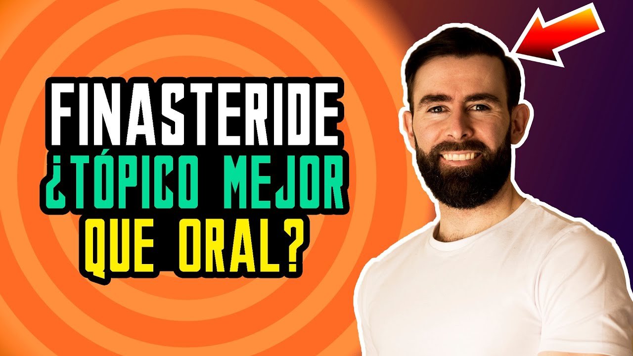 finasteride en pastillas vs tópica