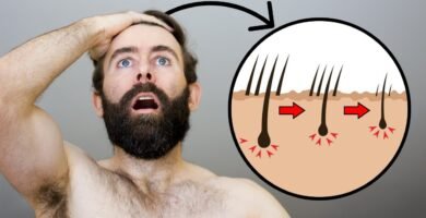 puedo combinar finasteride con biotina