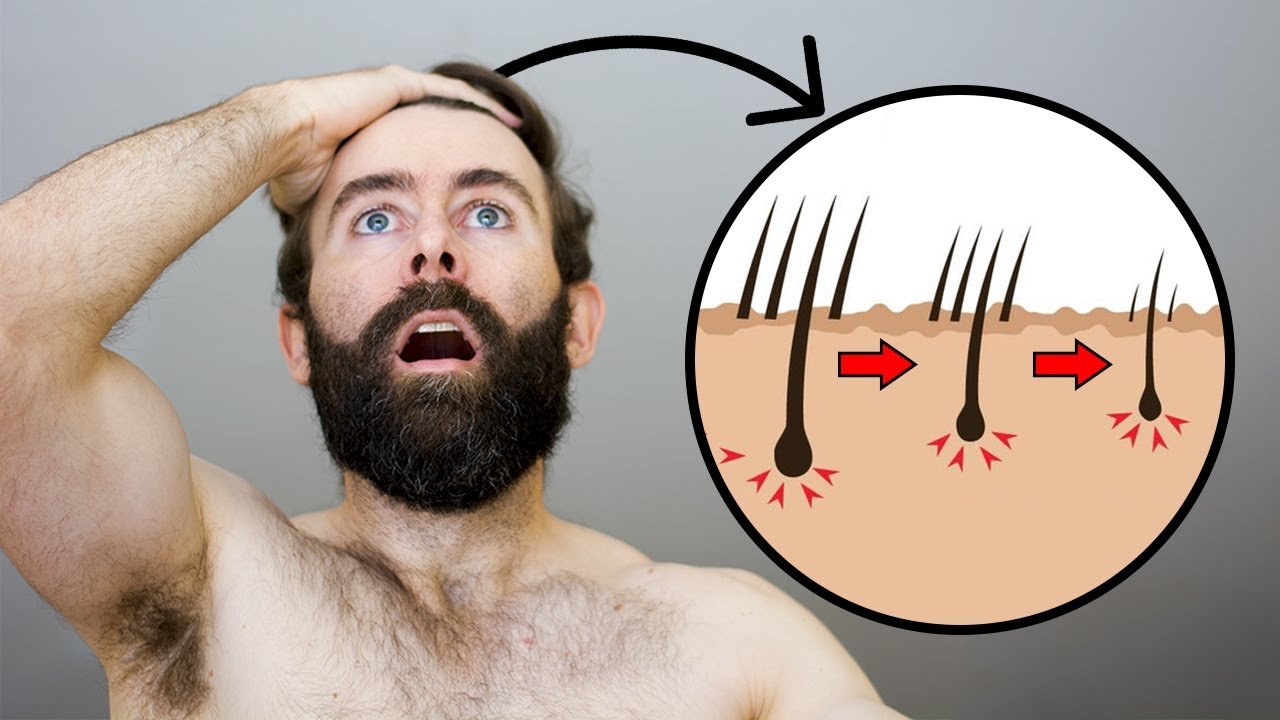 puedo combinar finasteride con biotina