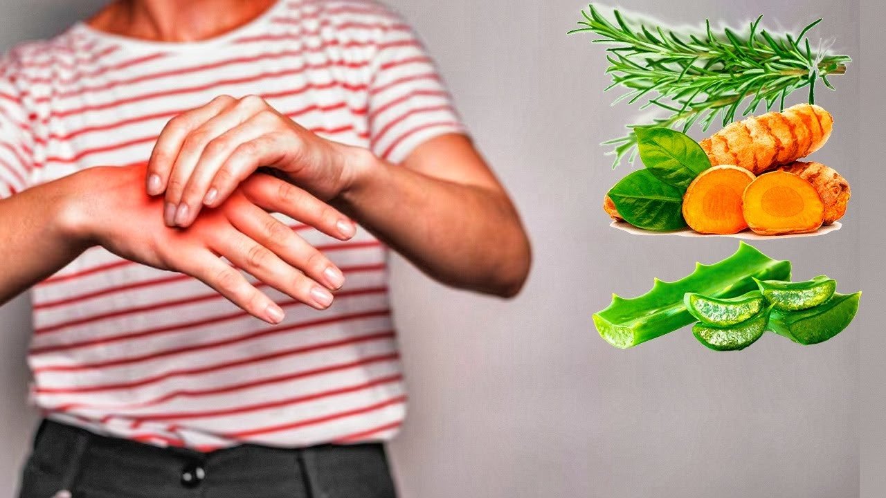 ¿Qué hacer si sufres de remedios caseros?