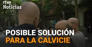 Avances científicos para tratar la alopecia en mujeres