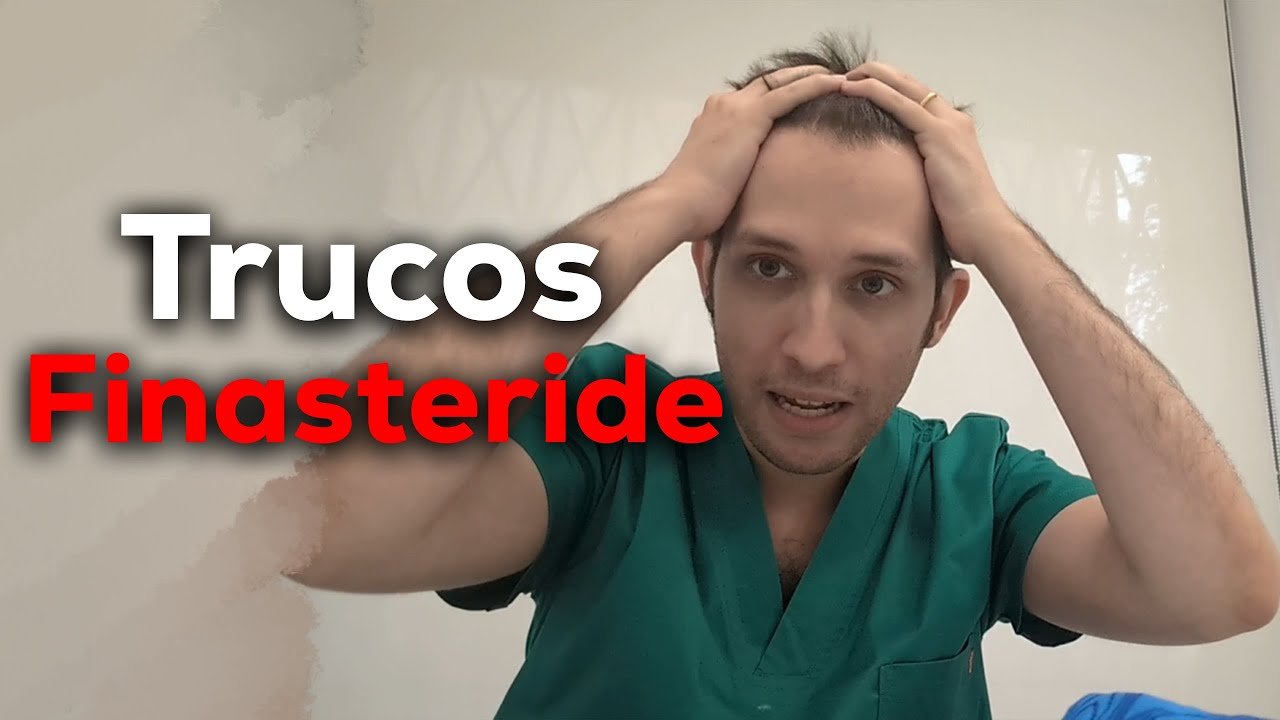 finasteride para entradas en hombres
