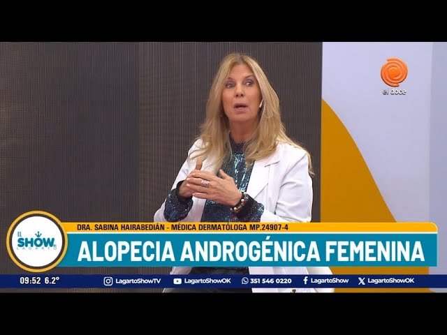 Alopecia androgénica en mujeres: cómo detectarla a tiempo