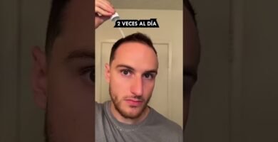 Cómo tratar la finasteride de forma natural