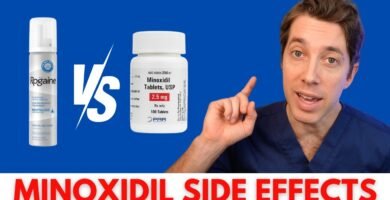 Minoxidil Kirkland vs Minoxidil You Minox: comparativa pros y contras