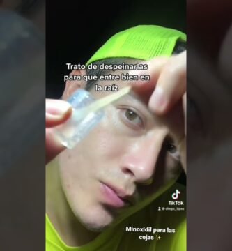 Minoxidil para cejas: aplicación y resultados resultados reales